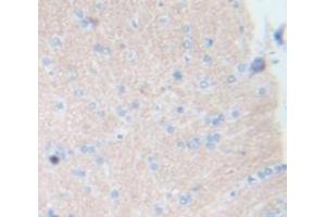 IHC-P analysis of Kidney tissue, with DAB staining. (Integrin alpha 1 anticorps  (AA 119-355))