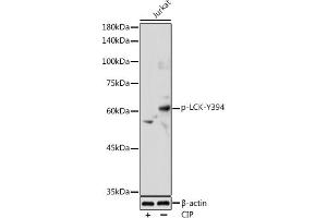 Western blot analysis of extracts of Jurkat cells, using Phospho-LCK-Y394 antibody (ABIN3019739, ABIN3019740, ABIN3019741 and ABIN7101863) at 1:1000 dilution. (LCK anticorps  (pTyr394))