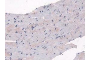 Detection of SULF2 in Mouse Heart Tissue using Polyclonal Antibody to Sulfatase 2 (SULF2) (SULF2 anticorps  (AA 337-654))
