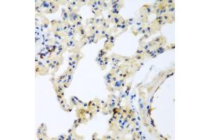 Immunohistochemistry of paraffin-embedded rat lung using LEPREL2 antibody (ABIN5971278) at dilution of 1/200 (40x lens).