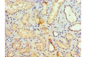 Immunohistochemistry of paraffin-embedded human kidney tissue using ABIN7155521 at dilution of 1:100 (SETDB1 anticorps  (AA 1-397))