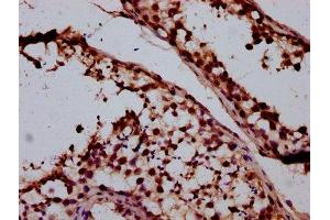 IHC image of ABIN7170858 diluted at 1:400 and staining in paraffin-embedded human testis tissue performed on a Leica BondTM system. (SMC1B anticorps  (AA 954-1060))