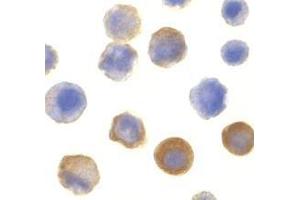 Immunocytochemistry of IRAK in HeLa cells with AP30438PU-N IRAK antibody at 10 μg/ml. (IRAK1 anticorps  (C-Term))