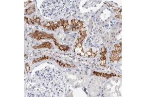 Immunohistochemical staining (Formalin-fixed paraffin-embedded sections) of human kidney with SLC22A12 polyclonal antibody  shows strong membranous positivity in cells in tubules. (SLC22A12 anticorps)