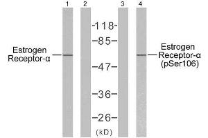 Western blot analysis of extracts from MCF7 cells, using Estrogen Receptor-α (Ab-106) antibody (E021066) and Estrogen Receptor-α (phospho-Ser106) antibody (E011071). (Estrogen Receptor alpha anticorps  (pSer106))