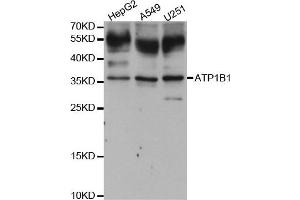 Western blot analysis of extracts of various cell lines, using ATP1B1 antibody. (ATP1B1 anticorps)