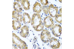 Immunohistochemistry of paraffin-embedded human gastric using M6PR antibody at dilution of 1:100 (x40 lens). (M6PR anticorps)