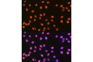 Immunofluorescence analysis of HeLa cells using SMC1 Rabbit mAb (ABIN7270614) at dilution of 1:100 (40x lens). (SMC1A anticorps)