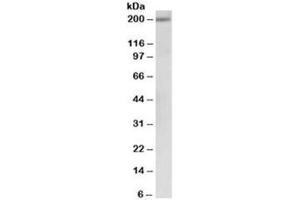 Western blot testing of human albumin-depleted serum lysate with alpha-2-macroglobulin antibody at 0. (alpha 2 Macroglobulin anticorps)