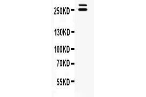 Western blot analysis of WNK1 expression in rat testis extract ( Lane 1).