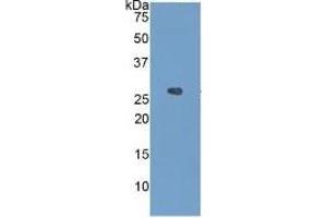 WB of Protein Standard: different control antibodies  against Highly purified E.