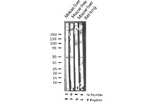 Western blot analysis of Phospho-ATF2 (Thr71 or 53) expression in various lysates