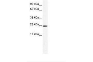 Image no. 1 for anti-Chloride Intracellular Channel 1 (CLIC1) (C-Term) antibody (ABIN6735458) (CLIC1 anticorps  (C-Term))