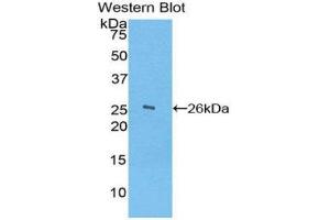 Western Blotting (WB) image for anti-Ficolin (Collagen/fibrinogen Domain Containing) 1 (FCN1) (AA 45-249) antibody (ABIN1858840) (FCN1 anticorps  (AA 45-249))