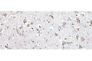 Immunohistochemistry of paraffin-embedded Human brain tissue using MCM10 Polyclonal Antibody at dilution of 1:45(x200) (MCM10 anticorps)