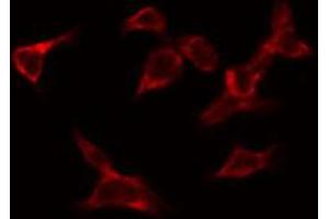 ABIN6269212 staining HeLa by IF/ICC. (CDC25A anticorps  (N-Term))