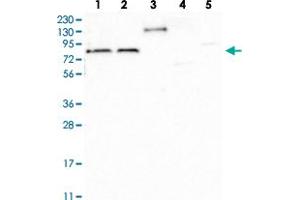 Western blot analysis of Lane 1: RT-4, Lane 2: U-251 MG, Lane 3: Human Plasma, Lane 4: Liver, Lane 5: Tonsil with TBC1D30 polyclonal antibody  at 1:100-1:250 dilution. (TBC1D30 anticorps)