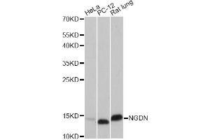 Western blot analysis of extracts of various cell lines, using VAMP8 antibody. (VAMP8 anticorps)