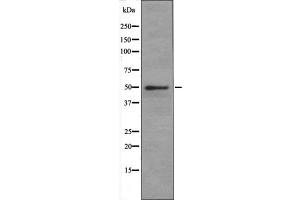 SLC1A5 antibody at 1 µg/ml + Jurkat (Human T cell lymphoblast-like cell line) Whole Cell Lysate. (SLC1A5 anticorps  (Internal Region))