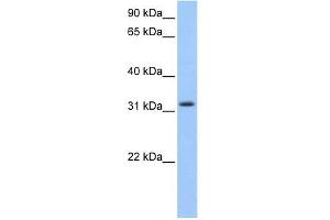 C14ORF140 antibody used at 1 ug/ml to detect target protein. (ZC2HC1C anticorps  (N-Term))
