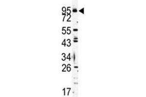 Western blot analysis of TLR6 antibody and K562 lysate