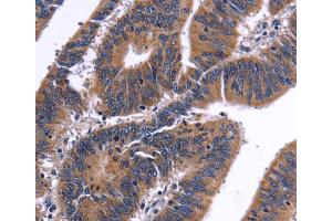 Immunohistochemistry (IHC) image for anti-Nuclear Factor of Activated T-Cells, Cytoplasmic, Calcineurin-Dependent 3 (NFATC3) antibody (ABIN2421908) (NFATC3 anticorps)