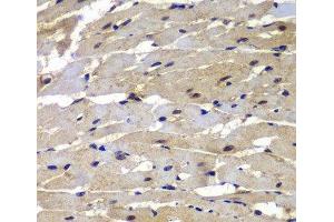 Immunohistochemistry of paraffin-embedded Rat heart using PSMB8 Polyclonal Antibody at dilution of 1:100 (40x lens). (PSMB8 anticorps)
