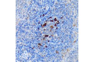 Immunohistochemistry of paraffin-embedded Rat spleen using P antibody (ABIN7269207) at dilution of 1:100 (40x lens).