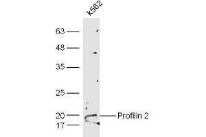 Human K562 cell lysates probed with Anti-Profilin 2 Polyclonal Antibody  at 1:5000 90min in 37˚C.