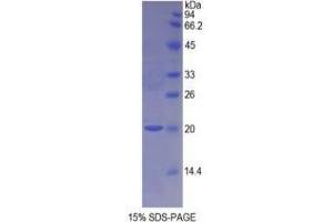 SDS-PAGE analysis of Rat NOS1 Protein. (NOS1 Protéine)