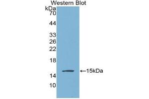 Western blot analysis of the recombinant protein. (AGGF1 anticorps  (AA 406-501))
