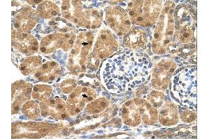 P4HB antibody was used for immunohistochemistry at a concentration of 4-8 ug/ml. (P4HB anticorps  (N-Term))