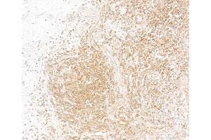 Immunohistochemistry (IHC) image for anti-Nuclear Factor of kappa Light Polypeptide Gene Enhancer in B-Cells 1 (NFKB1) (AA 1-50) antibody (ABIN7795780)