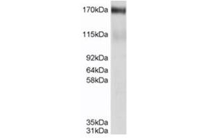 Image no. 2 for anti-ATP-Binding Cassette, Sub-Family C (CFTR/MRP), Member 4 (ABCC4) (C-Term) antibody (ABIN374484) (ABCC4 anticorps  (C-Term))