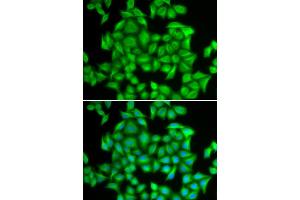 Immunofluorescence analysis of A549 cell using HNRNPA2B1 antibody. (HNRNPA2B1 anticorps  (AA 1-180))