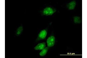Immunofluorescence of purified MaxPab antibody to TRMT2A on HeLa cell.