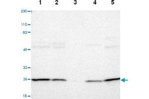 Western blot analysis of Lane 1: Human cell line RT-4, Lane 2: Human cell line U-251MG sp, Lane 3: Human plasma (IgG/HSA depleted), Lane 4: Human liver tissue, Lane 5: Human tonsil tissue with PSMD10 polyclonal antibody  at 1:250-1:500 dilution. (PSMD10 anticorps)