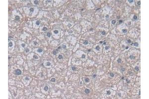 Detection of MTHFR in Human Liver Tissue using Polyclonal Antibody to Methylenetetrahydrofolate Reductase (MTHFR)