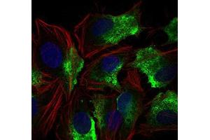 Immunofluorescence analysis of Hela cells using CD74 mouse mAb (green).