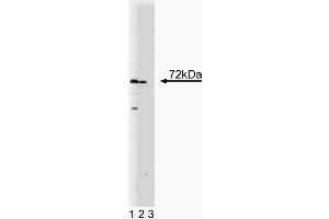 Western blot analysis of SNX2 on a human endothelial cell lysate. (Sorting Nexin 2 anticorps  (AA 15-137))