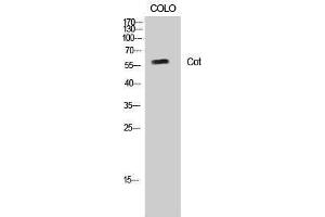 Western Blotting (WB) image for anti-Carnitine O-Octanoyltransferase (CROT) (Ser253) antibody (ABIN3174521) (CROT anticorps  (Ser253))