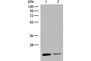Western blot analysis of Human empty ileal tissue and Human ileum tissue lysates using RAC3 Polyclonal Antibody at dilution of 1:400
