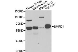 Western blot analysis of extracts of various cell lines, using SMPD1 antibody (ABIN5974079) at 1/1000 dilution. (SMPD1 anticorps)