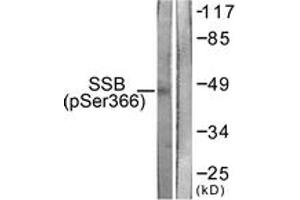 Western blot analysis of extracts from 293 cells, using SSB (Phospho-Ser366) Antibody. (SSB anticorps  (pSer366))