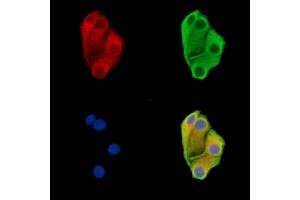 ABIN7096491 and ABIN7100555 staining Hela cells by IF/ICC. (DENND2D anticorps)