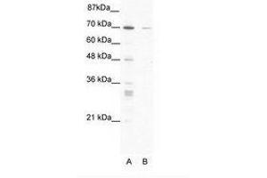 Image no. 1 for anti-Zinc Finger Protein 37A (ZNF37A) (AA 381-430) antibody (ABIN203208) (ZNF37A anticorps  (AA 381-430))