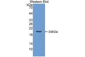 Detection of Recombinant FAS, Mouse using Polyclonal Antibody to Factor Related Apoptosis (FAS) (FAS anticorps  (AA 22-169))
