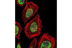 Fluorescent confocal image of Hela cell stained with NRK Antibody . (NRK anticorps  (AA 721-750))