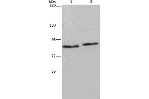 Western Blot analysis of 293T and K562 cell using ITGB2 Polyclonal Antibody at dilution of 1:600 (Integrin beta 2 anticorps)