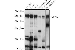 Western blot analysis of extracts of various cell lines, using SUPT6H antibody (ABIN7270645) at 1:1000 dilution. (Spt6 anticorps  (AA 1500-1726))